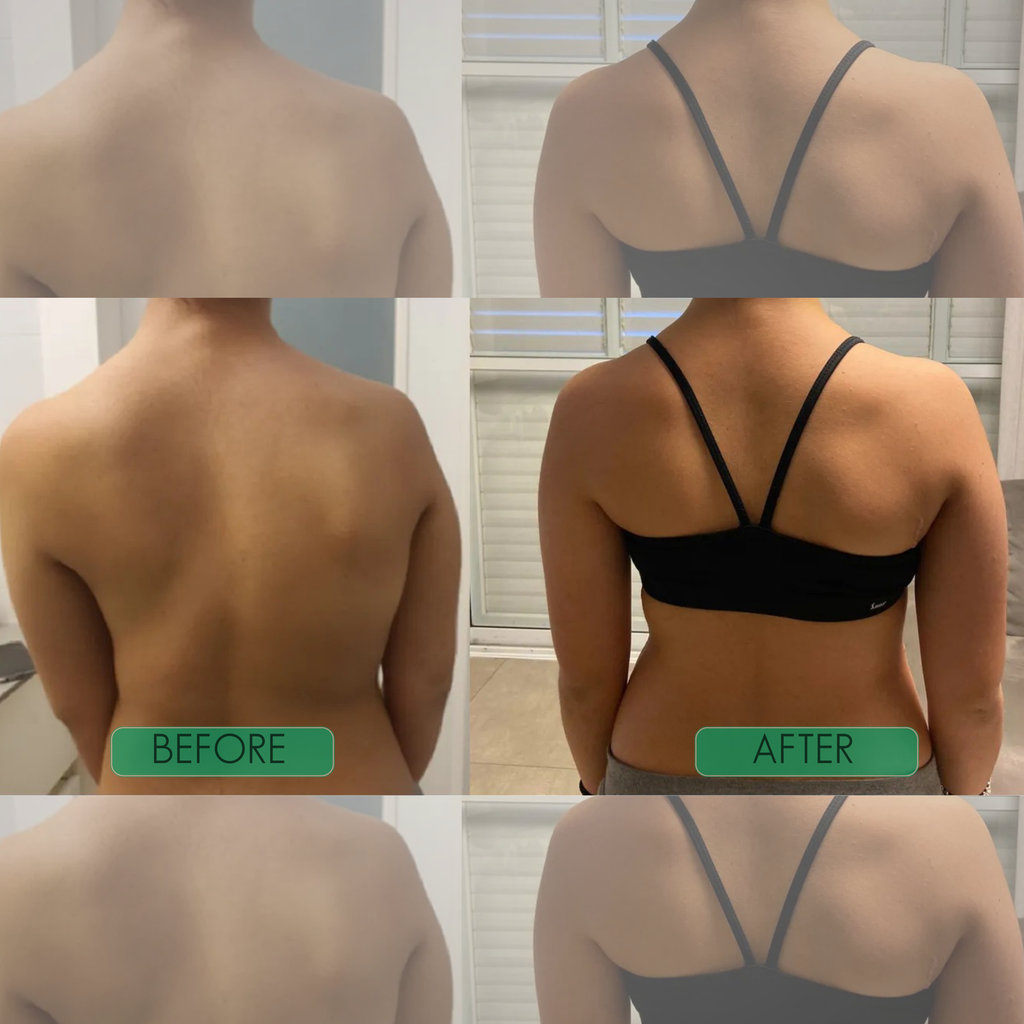 Instant Posture Correctorr